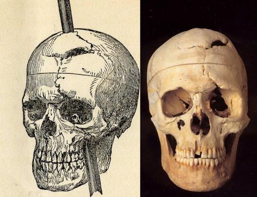Phineas gage 1868 skull.jpg